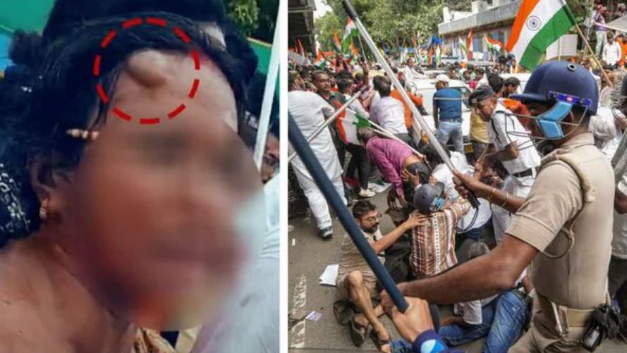 নির্যাতিতার বাবা-মাকে বেদম প্রহার পুলিশের? মেয়ের জন্য বিচার চাইতে মার খেতে হল প্রশাসনের!